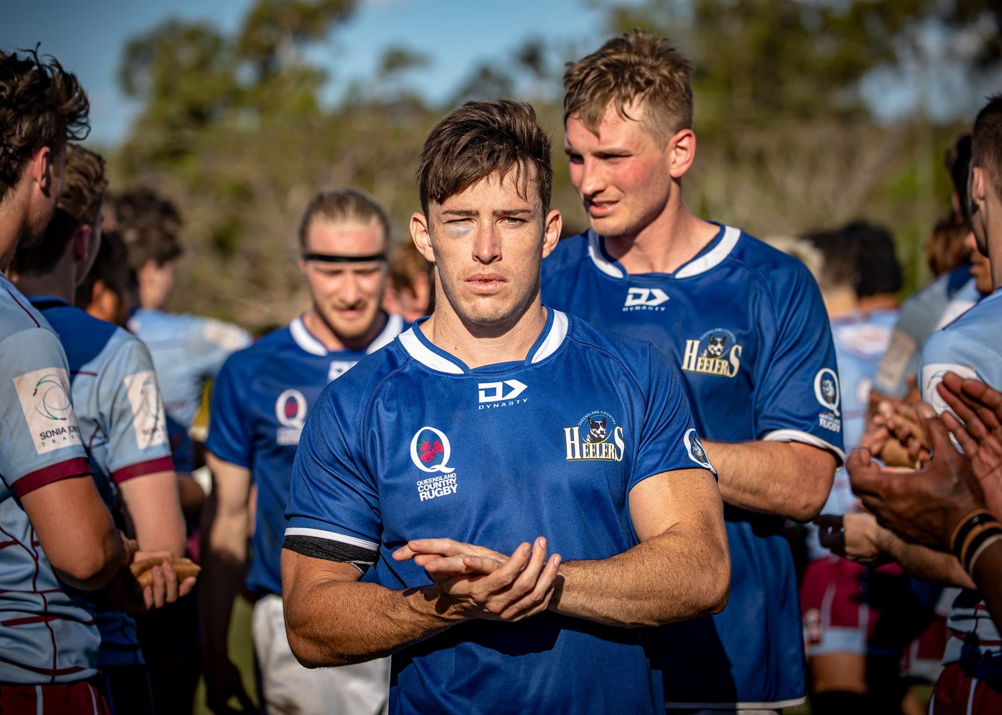 Josh with a black eye post a tough QLD Country v Norths fixture in 2021